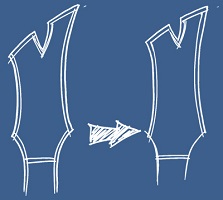 Kopfplattenbinding